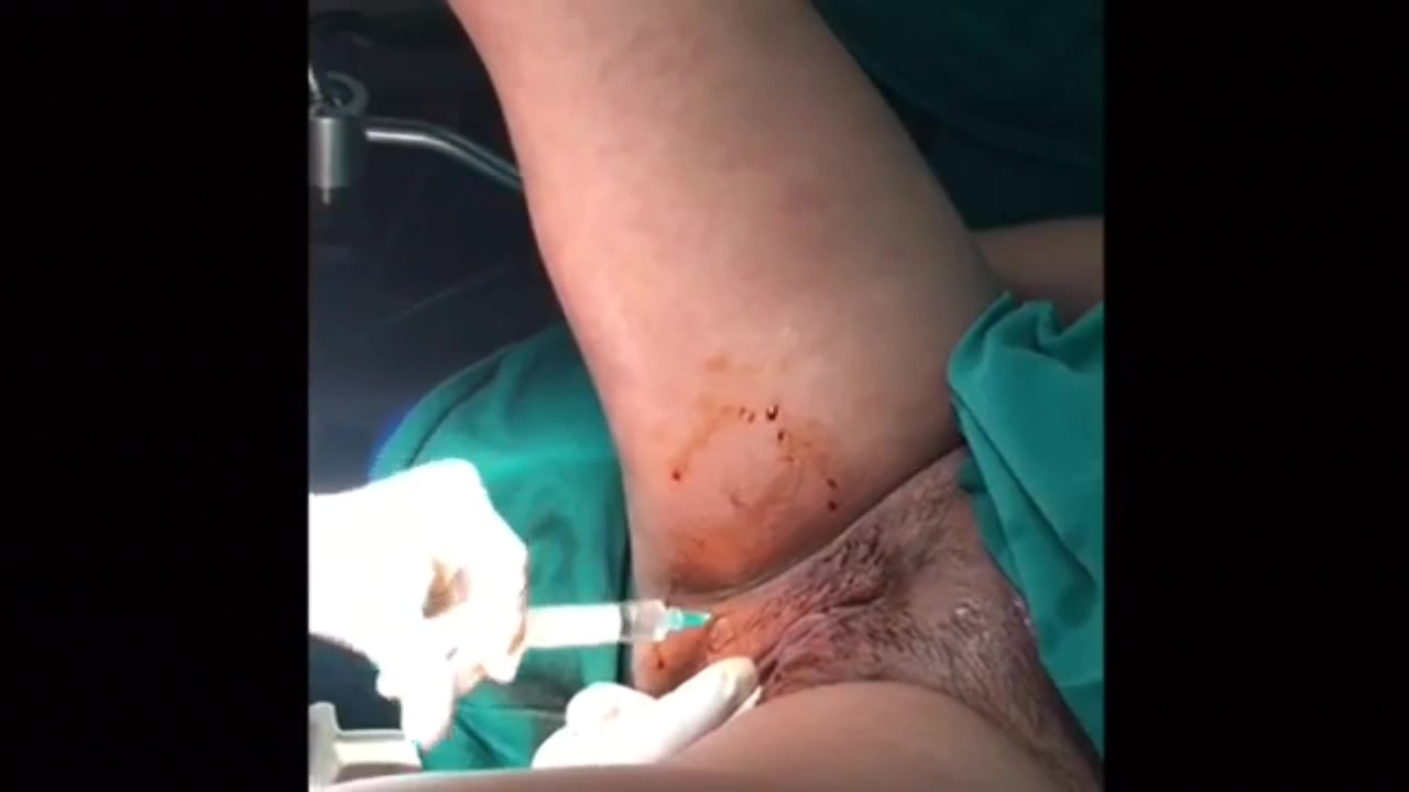 罕见稀有资源【直击女人各种样式分娩过程】做女人不容易啊，男人需要了解一下